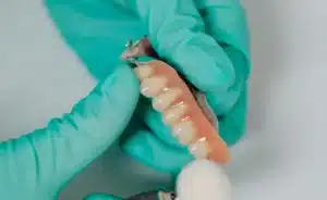 Dental Checkups in Laguna Hills