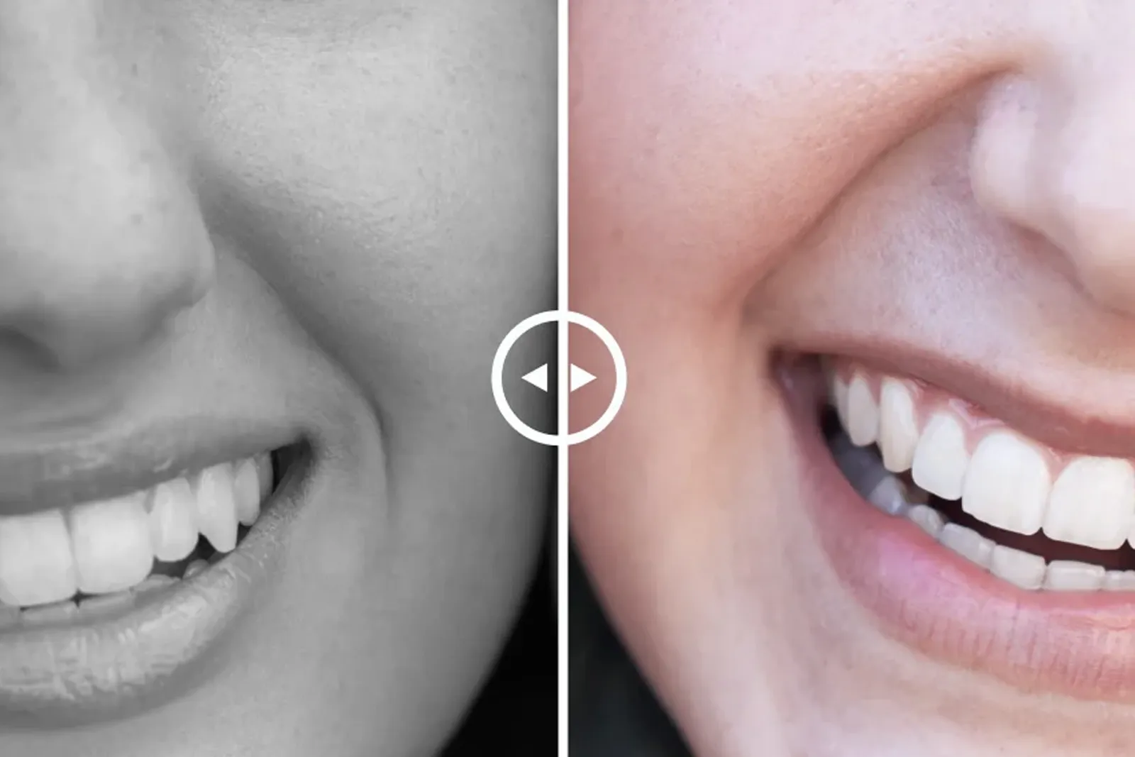 Cosmetic Denstistry at ND Dental Care Laguna Hills