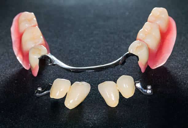 Dentures and Partial Dentures in Laguna Hills